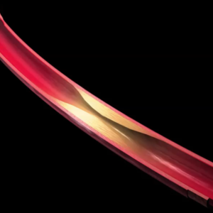 OPTICAL COHERENCE TOMOGRAPHY